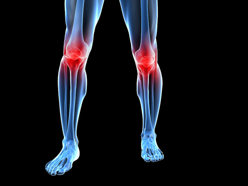 osteoarthritis treatment in Visalia